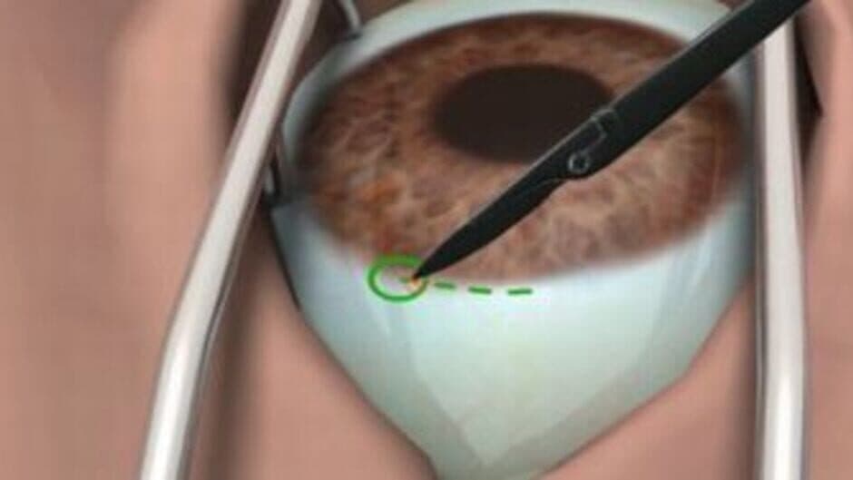 Surgery Simulator screenshot